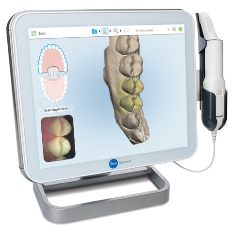 iTeroエレメント２で口腔内をスキャン