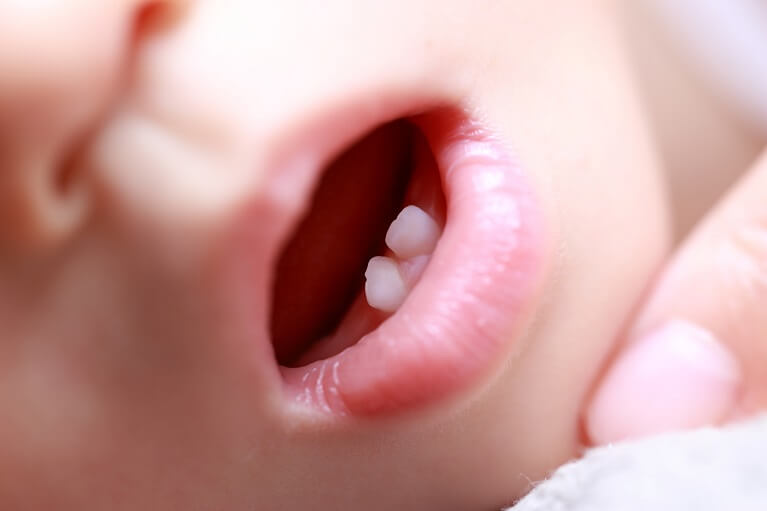 小児歯科はいつから通ったらいいの？